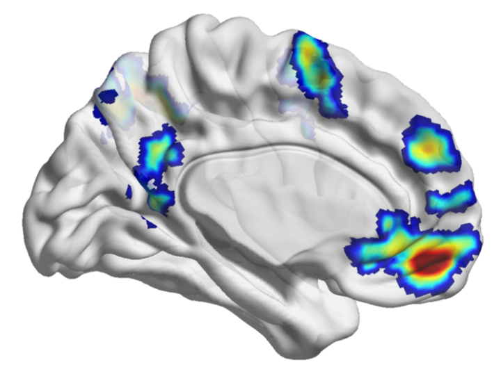 brain_activation